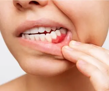 Avaliação das gengivas numa consulta de periodontologia